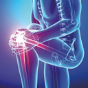 Orthopedics and Joint Replacement